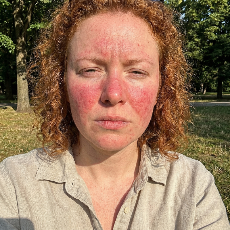 Michael Chen - Before